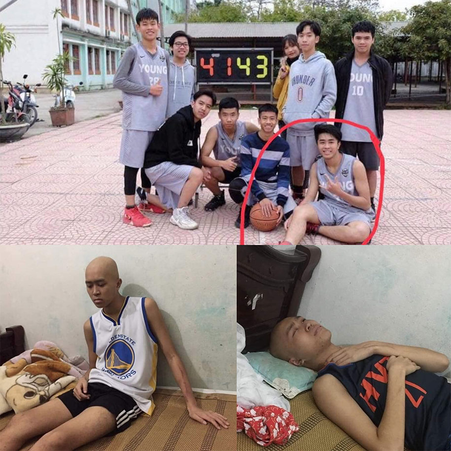 Cùng cộng đồng bóng rổ chung tay giúp baller trẻ bị ung thư tại thành phố Hoà Bình